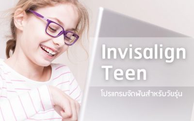 ‘Invisalign Teen’ โปรแกรมจัดฟันใสที่ออกแบบมา เพื่อวัยรุ่นโดยเฉพาะ