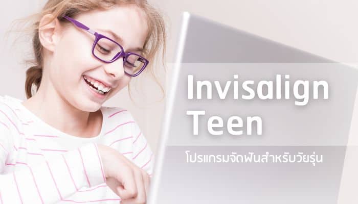 ‘Invisalign Teen’ โปรแกรมจัดฟันใสที่ออกแบบมา เพื่อวัยรุ่นโดยเฉพาะ